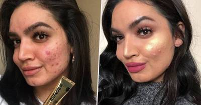 Beauty Blogger Left 'Humiliated' After L&rsquo;Oreal Drops Her Due To 'Skin Issues'