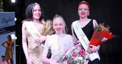 Zimbabwe Held First Ever Miss Albino Beauty Pageant To Fight The Stigma Surrounding It