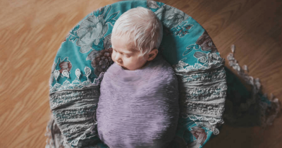 Mom Surprised When Her Second Baby Is Born With Snow White Hair