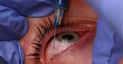 Woman Makes Shocking Discovery After Not Removing Mascara Properly For 25 Years