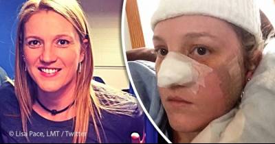 A Former 'Tan-oholic' Teen Now In the 40'S Had Over 86 Skin Cancer Surgeries Shares Her Experience To Raise Awareness