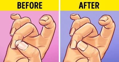 What Brittle Nails Say About Your Health And How To Fix It