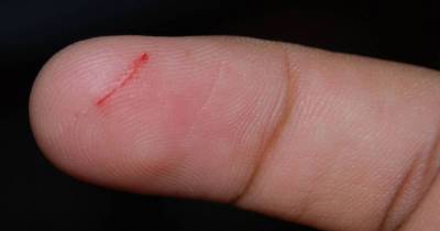 A Doctor Finally Tells Us The Reason Why Paper Cuts Hurt So Much?