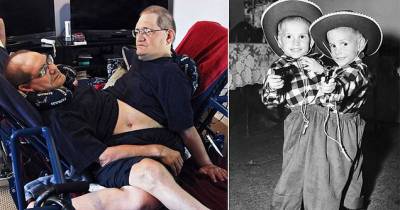 World's Longest Living Conjoined Twins Have Died Aged 68