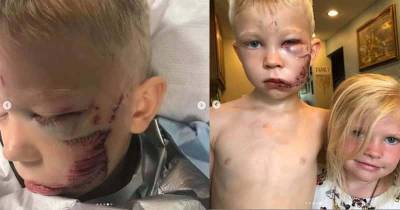 6-Year Old Boy Hailed Hero After He Saves His Little Sister From Dog Attack