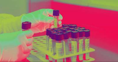 Experimental Blood Test Detects Cancer Up To Four Years Before Symptoms Appear