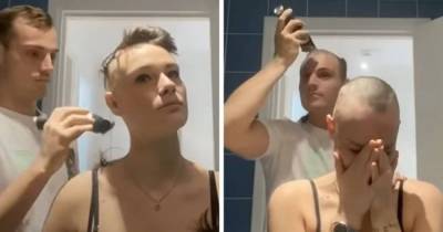 Due To Alopecia Boyfriend Shaves Girlfriend's Head Only To Shave His Own Immediately After