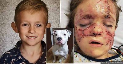 6-Year Old Kid Gets Horrifying Injuries After Getting Mauled By Family Pet Pit Bull Dog Named Chaos