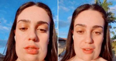 Teenager Who Went Viral With 'Square Head' Shows Off Final Results Two Months Post Treatment