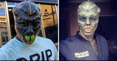 Man Who Wants To Be A Real-Life Alien Has Nose Removed And Tongue Split In Half