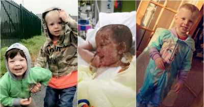 Dad Barged Into A Severely Burning Van To Save His Boys, Thought He Had Saved Both After Grabbing Two Limbs But He Only Rescued One