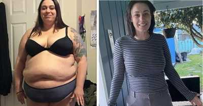 Obese Woman Who Gained 340lbs loses 180lbs After Flying To Mexico For Cheap Weight Loss Surgery