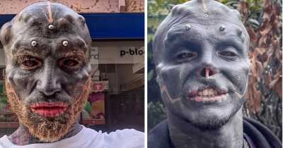 Frenchman Who Wants To Become A 'Black Alien' Has Had His Nose And Top Lip Removed In Latest Modification