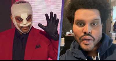 The Weeknd Finally Explains Why He's Been Wearing All Those Bandages