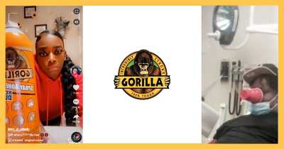 Gorilla Glue Saga Continues As Man Gets Plastic Cup Glued To Face