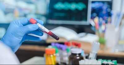 Argentinian Woman Becomes Second Person Ever To Be Naturally 'Cured' Of HIV