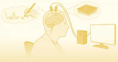 Computer Chip Implant Allowed A Paralysed Man To Type By Imagining Himself Writing