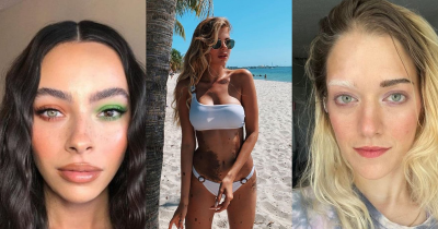 These People Shared Some Of The Most Beautiful 'deformities' You've Ever Seen.