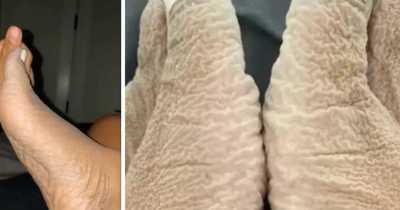 Woman Reveals What Happens When You Stay In The Bath For Too Long