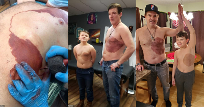 This Father Got A Giant Chest Tattoo Just Like His Son&rsquo;s Birthmark
