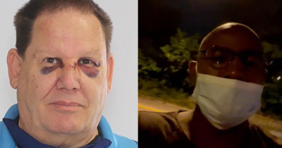 Racist Drunk Threatens Black Driver, Calls Him The N Word, Attacks His Car And Falls Flat On His Face