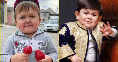 New Internet Sensation Hasbulla And His Enemy Abdu Rozik's Real Age Revealed And Explained By Doctor