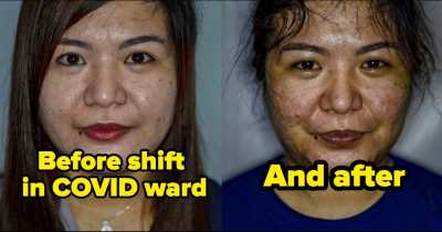 27 "Before and After Pictures" That Will Leave You Amazingly Surprised