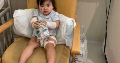 Scalding KFC Gravy Left Toddler Screaming In Agony And Suffering Horrific Burns