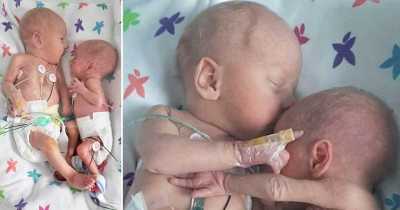 Twin Baby Gets Hugs And Cuddles From Premature Baby Girl Who Almost Didn't Make It