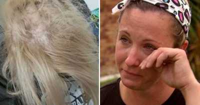 Mother Says Her Hair Started Falling Out After Her Home Flooded With Sewage