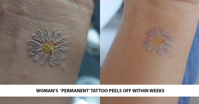 Woman Horrified After 'Permanent' Tattoo Starts Peeling Off