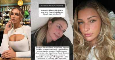 Zara Mcdermott Has Opened Up About Getting Botox At Just 25 Years Of Age Due To Having An &ldquo;Asymmetrical Face&rdquo;.
