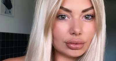 British Soldier's Filled Lips Called 'A National Security Threat' By Haters