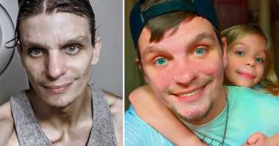 Addict Hooked On Meth At 13 Is Unrecognizable After Going Clean