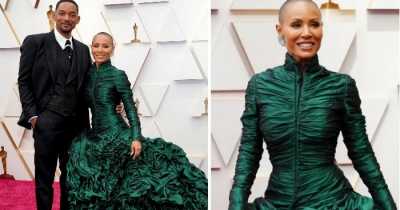 Jada Pinkett Smith's Heartbreaking History Of 'Hair Loss' As Will Smith Takes A Stand For His Wife At Oscars