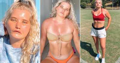 Tayla Clement Who Cannot Smile Lands A Modelling Contract