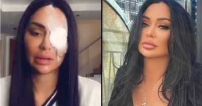 Australian TikToker Asked Terrifying Question Before Acid Thrown In Her Face