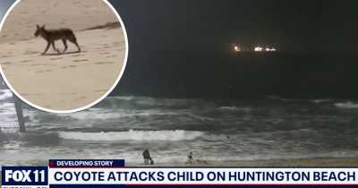 Bizarre Video Shows Vicious Coyote Attacking Toddler At Orange County Beach