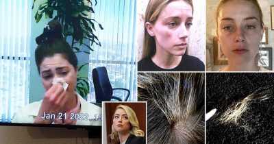 Amber Heard's Former Best Friend In Tears Describing Horror Injuries After Johnny's Alleged Abuse