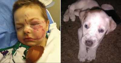 5yo Boy Unable To Smile After &lsquo;Sweet&rsquo; Dog Ripped Off His Cheek In Bed