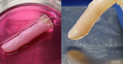 Scientists Create Robot Finger With Human Skin That Heals Itself