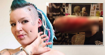Woman Cuts Off Her Arm Tattoo Having Her Cheating Boyfriend's Name And Mails Him The Skin