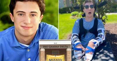University Of Missouri Frat Brothers Charged With Felony After Inflicting Painful Injury On Student, 19