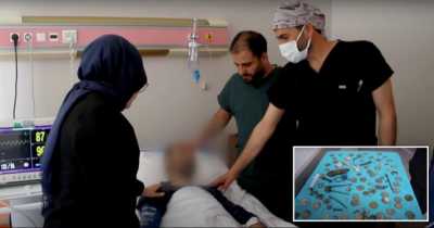 Bizarre: Doctors Find 233 Coins, Batteries, Screws And Glass Shards In Man's Stomach