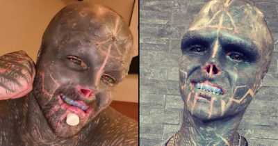 Black Alien Planning On Getting Leg Amputation After Slicing Off His Ears And Lips