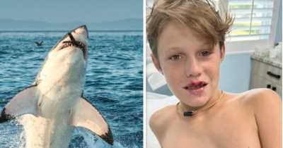 Boy Rushed To Hospital With &lsquo;Blood Gushing Out Of His Face&rsquo; After Getting Attacked By Shark
