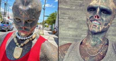 'Black Alien' Tattoo Addict Has Skin Carved Out Of Head To Spell Nickname