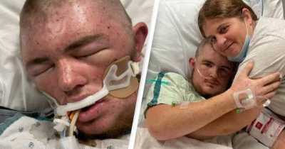 Ohio Man Put On Life Support After Being Stung By Bees 20,000 Times, Swallowing 30