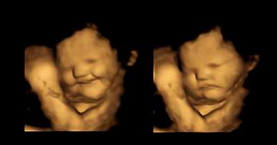Ultrasounds Show Fetuses Smiling In The Womb After Their Mothers Ate Carrots But Scowled Over Kale