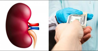 Google Is Displaying Ads To Sell Your Kidney For $1m In India